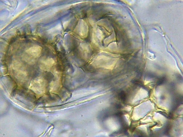 Tuber aestivum dalla fotografia alla microscopia